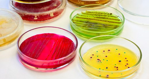 Fortsatt ökning av resistenta bakterier