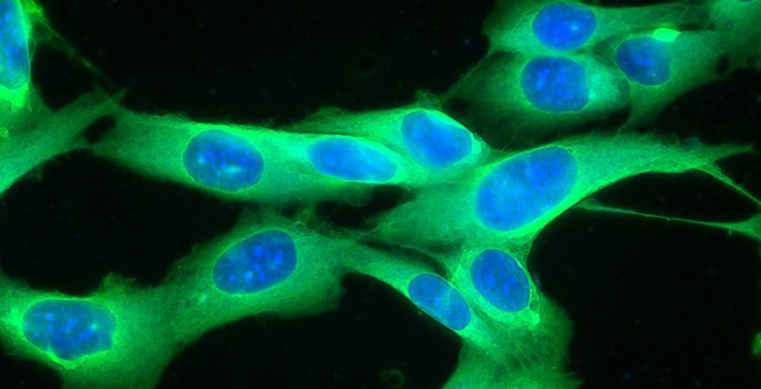 melanominsida-1