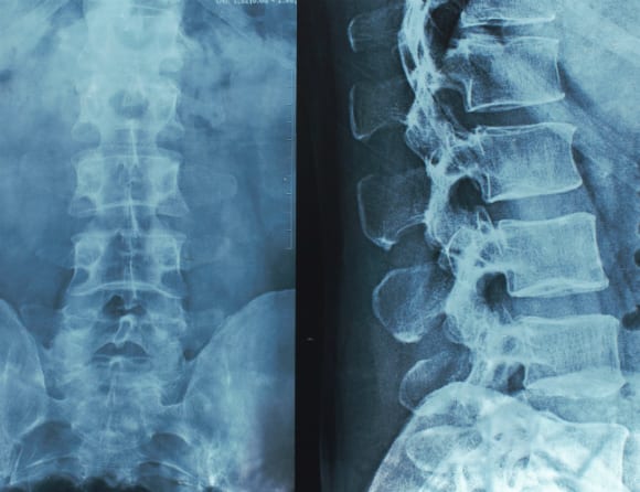 Företag som erbjöd hjälp att tolka röntgenbilder fälls