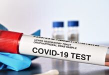 Bara sex fall totalt i masstestningen i Umeå Läkemedelsvärlden