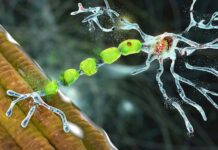 Klartecken för ny terapi mot ovanlig form av ALS Läkemedelsvärlden