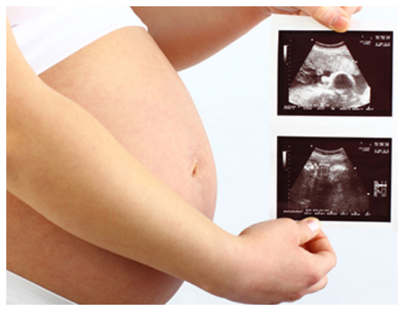 Gravid WP1 Istock