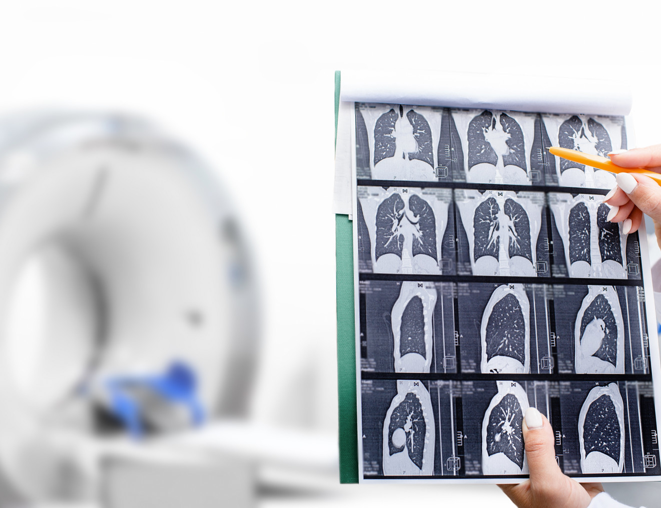 “Lung cancer screening could save 500 lives a year.”