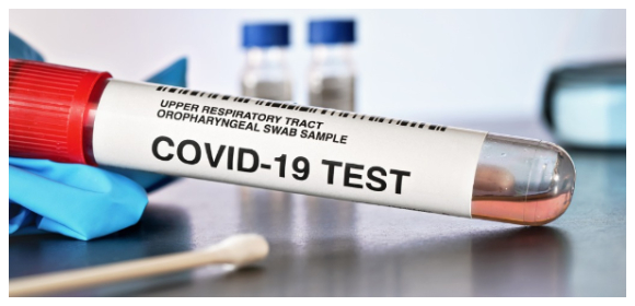 PCR-test för covid-19. VP2