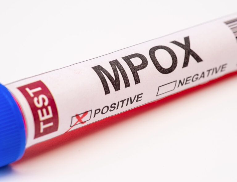 Antiviral terapi utan effekt mot mpox i fas III-studie