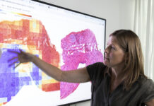 AI hittar missad prostatacancer Carolina Wählby. Foto: Mikael Wallerstedt