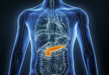 AI upptäcker cancer i bukspottkörteln