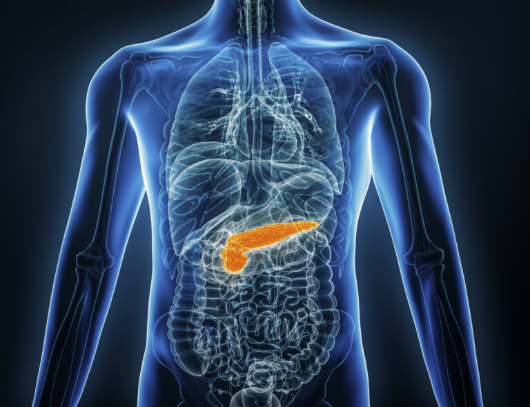 AI upptäcker cancer i bukspottkörteln