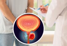 Östrogenplåster lika effektiva som standardbehandling vid prostatacancer Patient med prostatacancer som blir erbjuden östrogenplåster som behandling