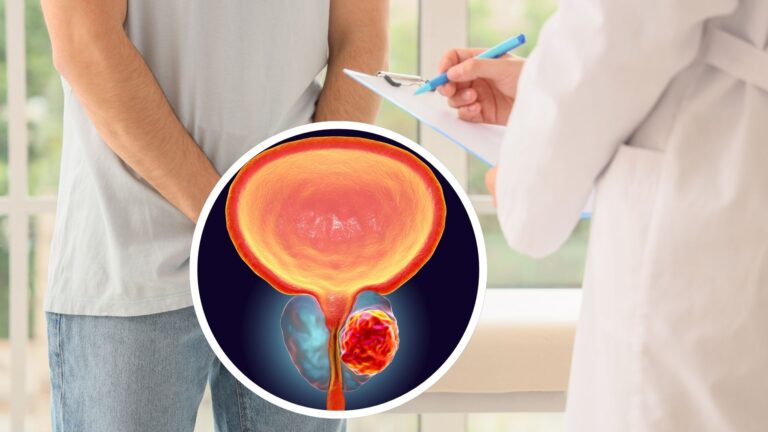 Östrogenplåster lika effektiva som standardbehandling vid prostatacancer