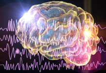 Nu subventioneras cannabisbaserat läkemedel mot svår epilepsi Hjärna vid epilepsi, illustration