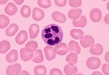 Neutrofiler kan hämma effekten av immunterapi vid cancer Neutrofiler