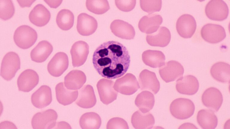 Neutrofiler kan hämma effekten av immunterapi vid cancer