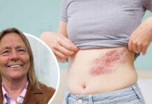 Historiskt kommunalt beslut om bältrosvaccin – väcker ilska i grannkommun Desirée Björk
