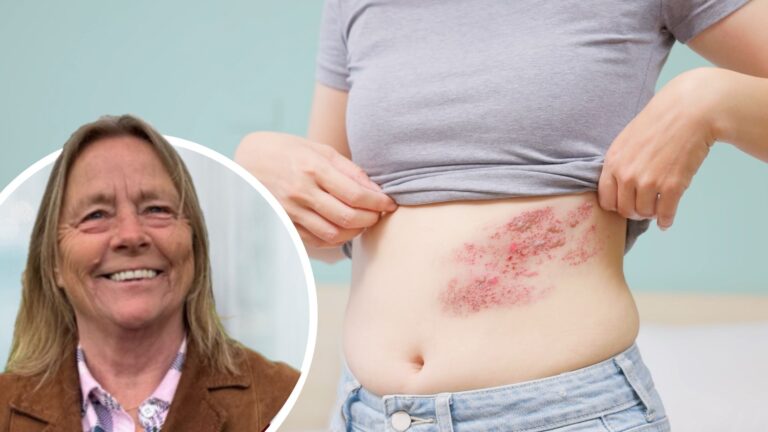 Historiskt kommunalt beslut om bältrosvaccin – väcker ilska i grannkommun