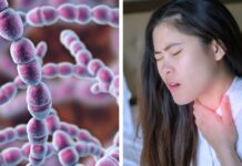 Antibiotika vid halsont har liten effekt på smittspridning av streptokocker Streptokocker