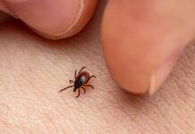 För få utomhusarbetare vaccinerar sig mot TBE Fästing på en arm.
