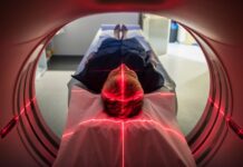 FDA godkänner nytt tau-test för Alzheimers sjukdom Person i en PET-scan