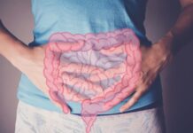 Tarmfloran kan avslöja framtida risk för typ 2-diabetes En mage med tarmar illustrerade ovanpå till en artikel om tarmflora och diabetes typ-2.