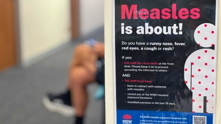 Australiens mässlingsskydd utmanas – svenskt utbrott blottar riskerna med sviktande flockimmunitet