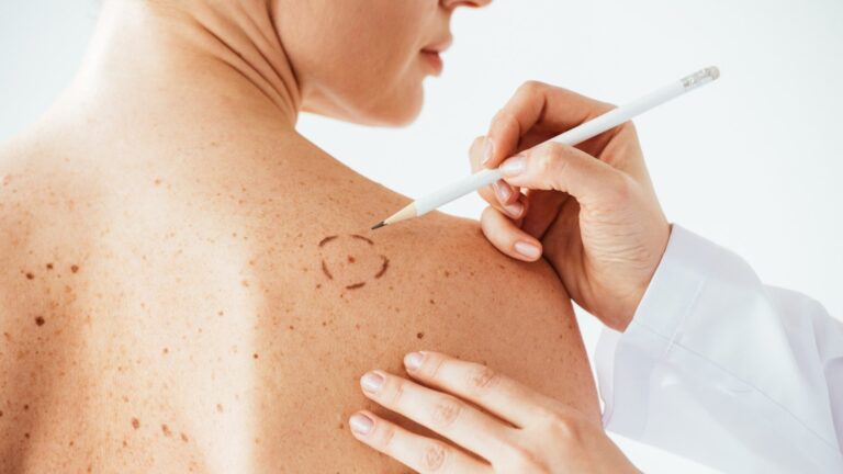 Individanpassat mRNA-vaccin når målen i fas 3-studie mot melanom